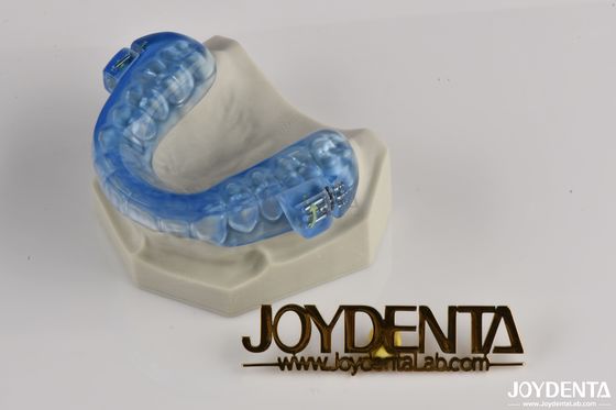 Thiết bị ngáy răng trong suốt Bảo vệ miệng Giảm ngáy Bảo vệ răng thoải mái