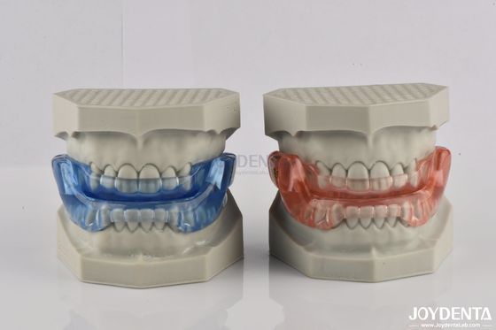 Thiết bị răng để ngăn chặn ngáy