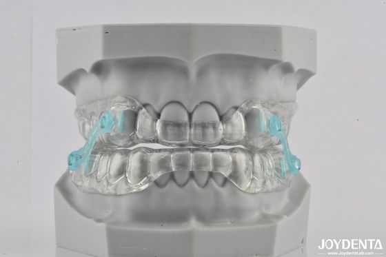 Silicone chống ngáy miệng ngăn ngáy thiết bị nha khoa thoải mái