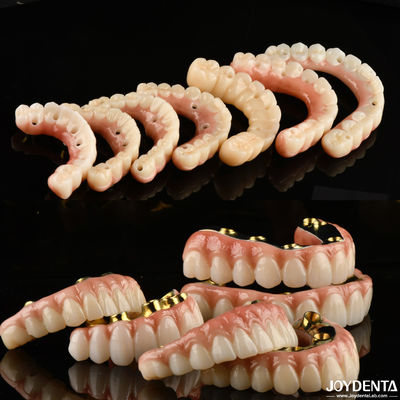 Cây ghép vương miện và cây cầu - Sự lựa chọn đáng tin cậy và đã được chứng minh cho việc tái tạo răng