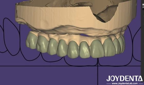 Thiết kế cá nhân Thiết kế chẩn đoán kỹ thuật số Wax Up Lab Phần mềm tích hợp liền mạch