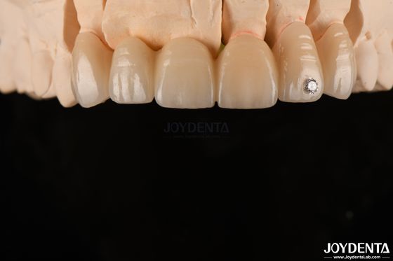 CAD / CAM Sơn răng Zirconia lớp cho vương miện đơn 0.3-0.5mm Độ dày lớp