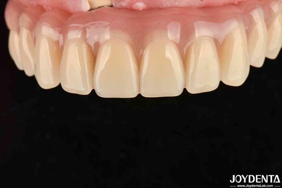 Làm khô nhanh 5 phút răng Acrylic kết thúc cho nha khoa răng phục hồi