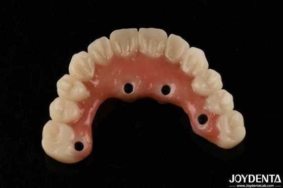 Làm khô nhanh Titanium Bar Acrylic răng hoàn thiện rõ ràng Acrylic răng Dental Supplies