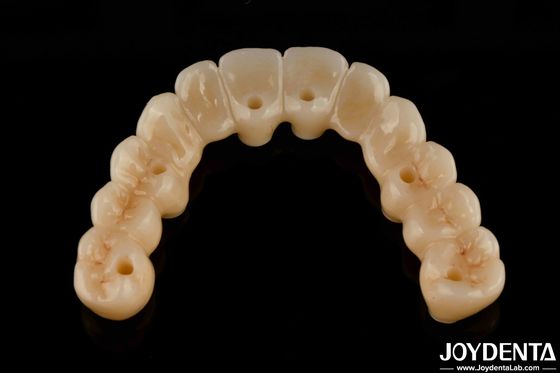 Cây cầu lai Zirconia linh hoạt cao với cơ sở titan