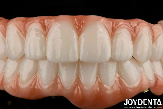 Đường Titanium lâu bền Zirconia cầu lai trông tự nhiên