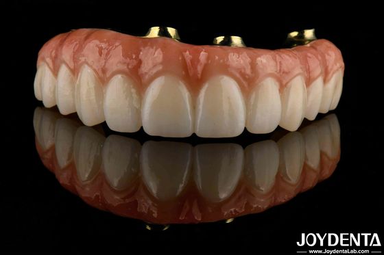 Dễ mặc Titanium Bar Zirconia Hybrid Bridge Tăng khả năng tương thích sinh học lâu dài