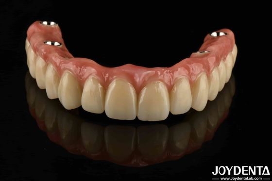 Khách hàng Titanium Malong Dental Hybrid Bridge Kháng ăn mòn điều chỉnh