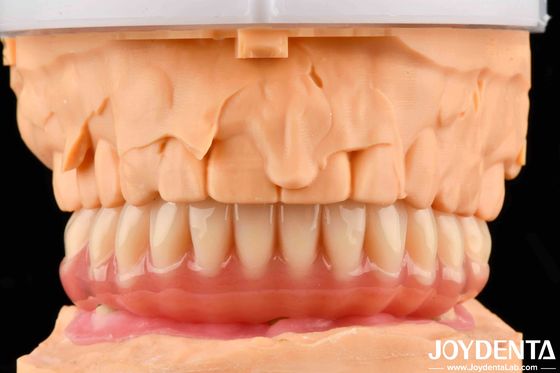 Mẫu răng giả acrylic trông tự nhiên hoàn thiện khả năng tương thích sinh học cao với công nghệ sắp xếp răng