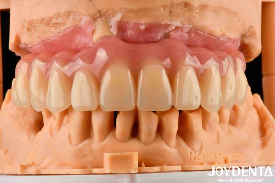 Dễ mặc răng giả acrylic hoàn thiện với công nghệ sắp xếp răng