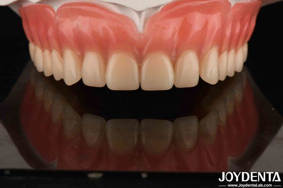 Acrylic Teeth Finish Lightweight Resin Material Phục hồi răng