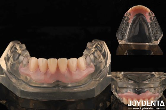 Công nghệ sắp xếp răng Denture linh hoạt hoàn thiện độ đàn hồi cao tùy chỉnh