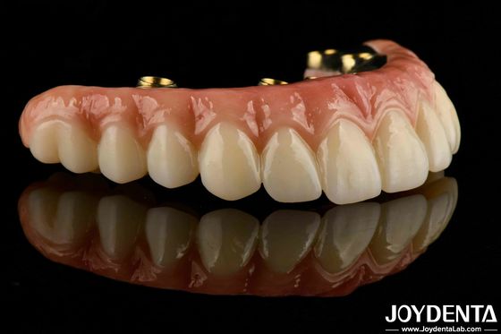 Tự làm cho mỗi bệnh nhân Ti-Bar Zirconia Hybrid Bridge cho răng giả lâu dài
