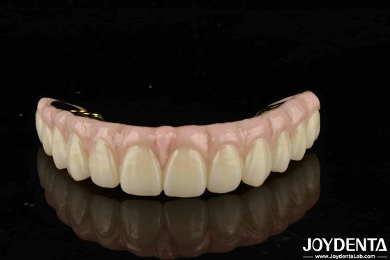 Độ bền cao Zirconia giải pháp cuối cùng cho răng tự nhiên và nướu răng tương thích