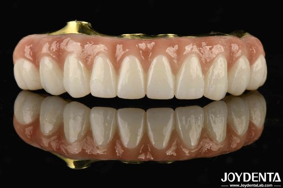Titanium và Zirconia thoải mái thoải mái để đeo Ti-Bar Zirconia cầu lai để thay thế của răng bị thiếu