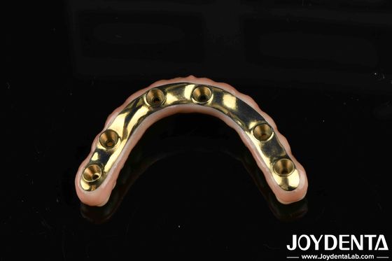 Cây cầu lai Ti-Bar Zirconia tùy chỉnh cho sự thoải mái và bền vững trong phục hồi răng