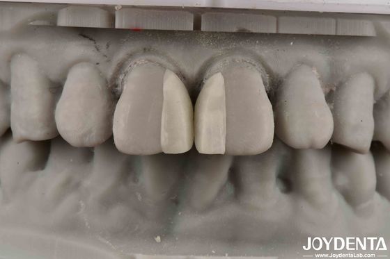 Bề mặt cong chống cháy Micro veneer cho trang trí nội thất