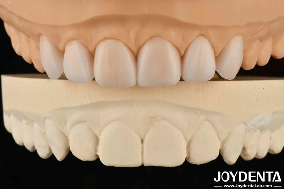 Sản phẩm nhẹ Denture linh hoạt hoàn thiện tùy chỉnh cá nhân cho các thông số kỹ thuật khác nhau