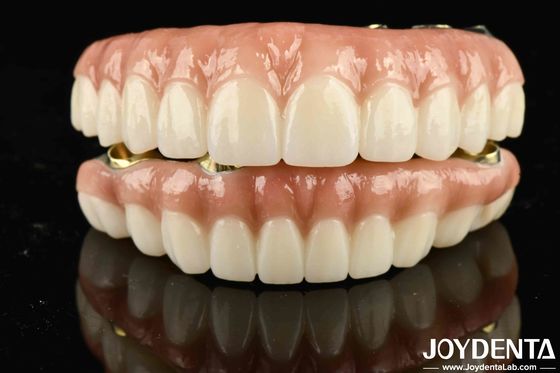 Cây cầu lai Ti-Bar Zirconia độ bền cao để đạt được tính thẩm mỹ