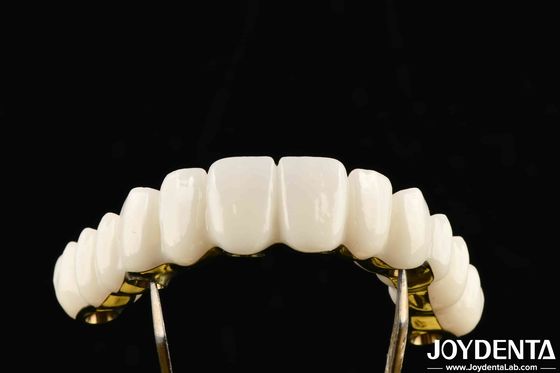 Đơn vị làm Zirconia Sức mạnh tuyệt vời cho các giải pháp nha khoa cá nhân