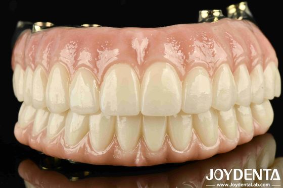 Cây cầu lai cao độ bền Ti-Bar Zirconia được sản xuất tùy chỉnh để đảm bảo sự hài lòng cá nhân
