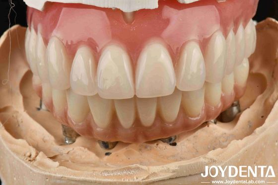 Độ đàn hồi tốt răng giả acrylic răng giả kết thúc với công nghệ sắp xếp răng
