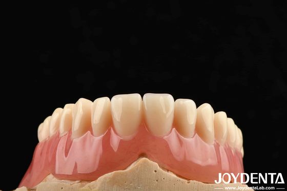 Độ đàn hồi tốt Acrylic răng giả hoàn thiện cho nhẹ tùy chỉnh cá nhân hóa và thiết kế tùy chỉnh
