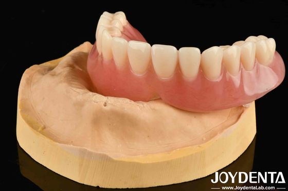 Độ đàn hồi tốt răng giả acrylic kết thúc công nghệ sắp xếp răng đa dạng cho kết quả trông tự nhiên