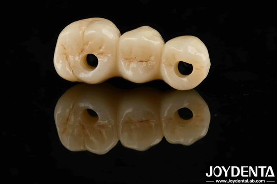 Tính thẩm mỹ cao Độ bền uốn cong cao 1000 MPa Full Zirconia For Standards