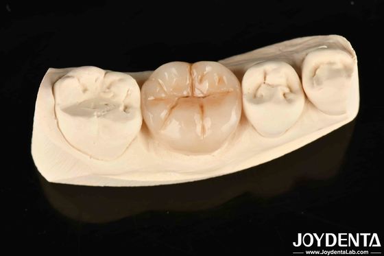 Full Zirconia chống mòn cao và sức mạnh trong các ứng dụng công nghiệp