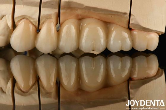 Tròn Zirconia màu trắng với khả năng chống sốc nhiệt cao