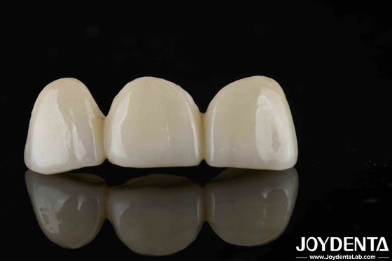 Phong cách trông tự nhiên với các lớp đầy đủ Zirconia Độ xuyên suốt cao và thẩm mỹ