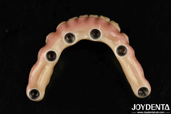 Đường cầu lai Malong Titanium bền cho chăm sóc nha khoa