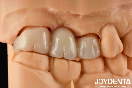 Trải nghiệm màu sắc thực tế Zirconia đầy đủ với khả năng chống nhuộm cao và độ bền uốn cong 1000 MPa