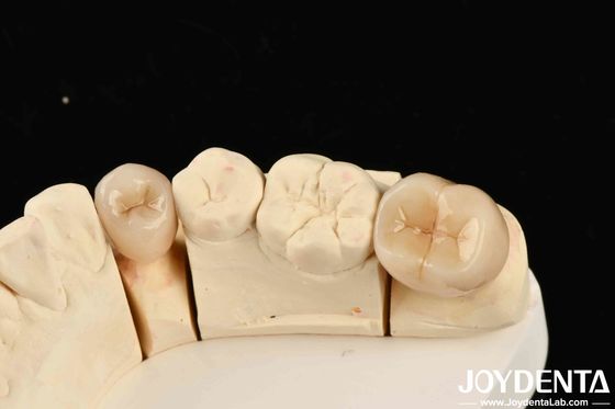 Tương thích sinh học tuyệt vời Zirconia đầy đủ với khả năng chống ăn mòn cao và độ bền uốn cong 1000 MPa