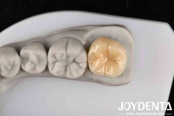 Chống nhiệt cao và ăn mòn Zirconia đầy đủ với sự ổn định hóa học tuyệt vời