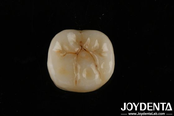 Tăng độ mờ cao Zirconia đầy đủ với các lớp Biocompatibility và độ bền uốn cong 800 MPa