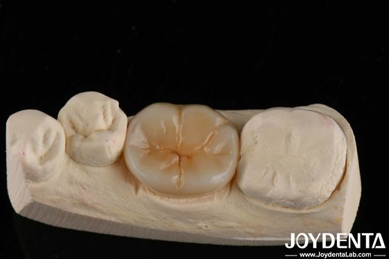 800 MPa Sức mạnh uốn cong và 8 MPa · m1/2 Độ cứng gãy trong nhiều lớp Zirconia đầy đủ cho các ứng dụng sức mạnh