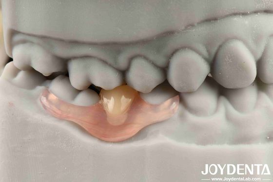 Flexible Denture Finish tùy chỉnh cá nhân hóa và công nghệ sắp xếp răng tiên tiến cho nhu cầu tùy chỉnh