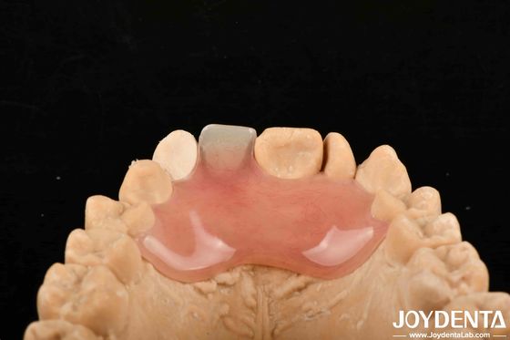 High Stealth Good Elasticity Flexible Denture Finish cho các quy trình sản xuất đa dạng