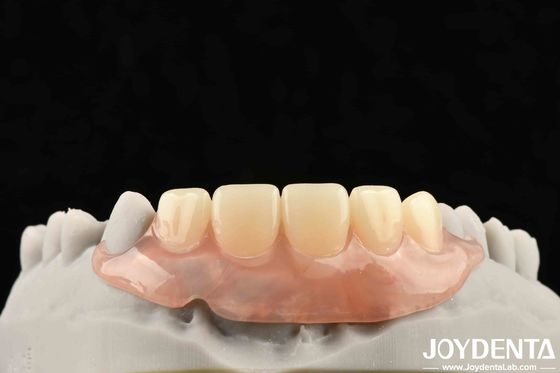 Xây dựng khuôn khổ công nghệ thiết lập răng hoàn thiện cho cấu trúc răng miệng ổn định trong công nghệ nha khoa áp dụng cho nha khoa