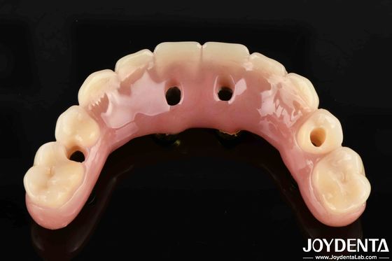 50ml Ti-Bar Acrylic Teeth Finish Thời gian chữa trị 24 giờ Hoa Kỳ Đối với các chuyên gia nha khoa