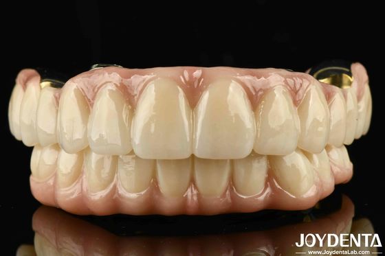 Đường cầu lai Ti-Bar Zirconia sức mạnh tuyệt vời cho răng tự nhiên và sự tương thích nướu răng