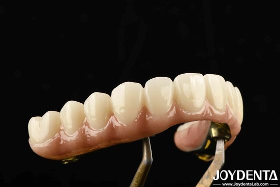 Cầu lai Ti-Bar Zirconia bền được làm từ Titanium và Zirconia vật liệu cho chúng ta nặng