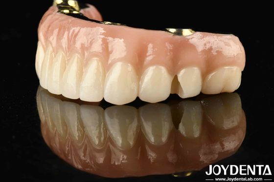 Chuyển đổi khôi phục răng của bạn với Ti-Bar Zirconia Hybrid Bridge bền và lâu dài