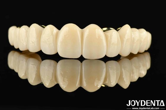 Cây cầu lai Ti-Bar Zirconia được làm theo yêu cầu sự kết hợp hoàn hảo cho sự thoải mái và chức năng