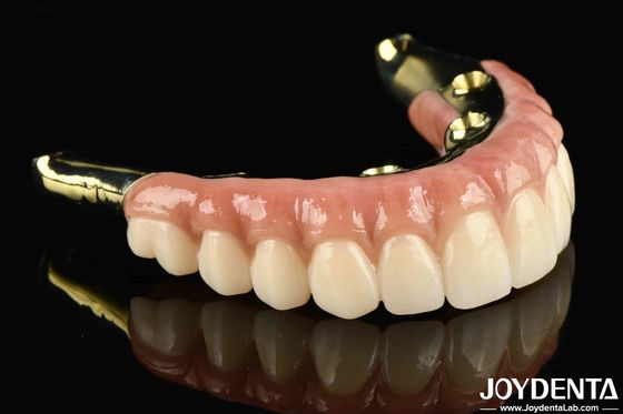 Nói lời tạm biệt với những chiếc răng bị mất bằng Zirconia trông tự nhiên và bền