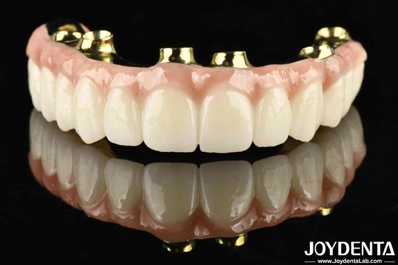 Cầu lai Ti-Bar Zirconia bền và lâu dài với khả năng chống ăn mòn và mòn