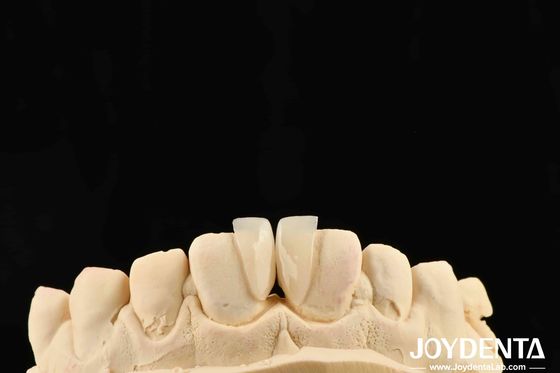 Độ bền cao Micro Veneer 0.2mm Độ dày Và Hiệu suất đáng tin cậy