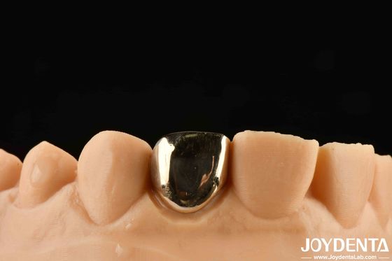 Trải nghiệm phục hồi răng miệng như chưa từng có với Gold Crown Wax Casting
